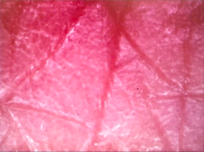 skin test-skin analysis