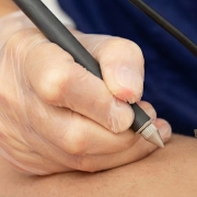 Elettrodepilazione con ago a Pavia